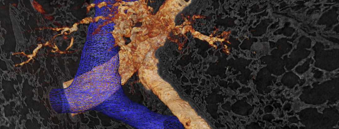 Workshop: 3D biomedical imaging with synchrotron radiation: State-of-the-art and future possibilities – LINXS event